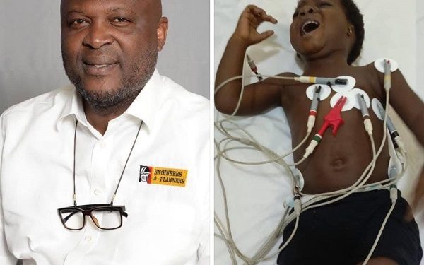 Ibrahim Mahama steps in to fund $10,500 medical bill for 2-year-old girl with hole in heart 1 Ibrahim Mahama has settled medical bills of 2-year-old suffering heart disease